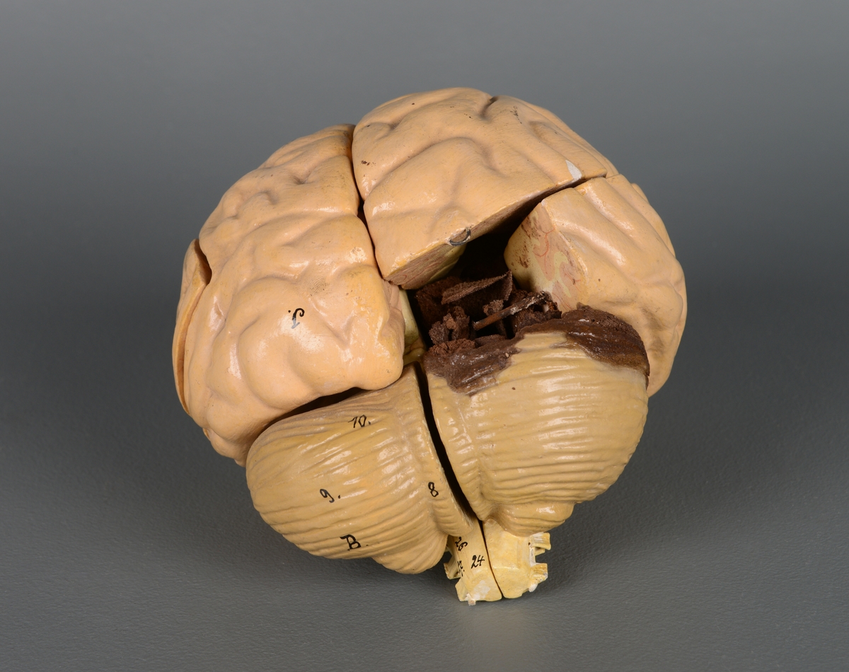 Undervisningsmodell/anatomisk modell av en hjerne. Gjenstanden består av åtte, opprinnelig ni, deler som kan åpnes og festes sammen med tynne metallstenger. En del mangler ved høyre bakhodelapp. De anatomiske delene er merket med tall og bokstaver.
Høyre side av lillehjernen er misfarvet og delvis ødelagt.