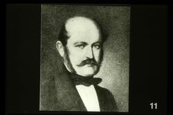 Ignaz Philip Semmelweiss
