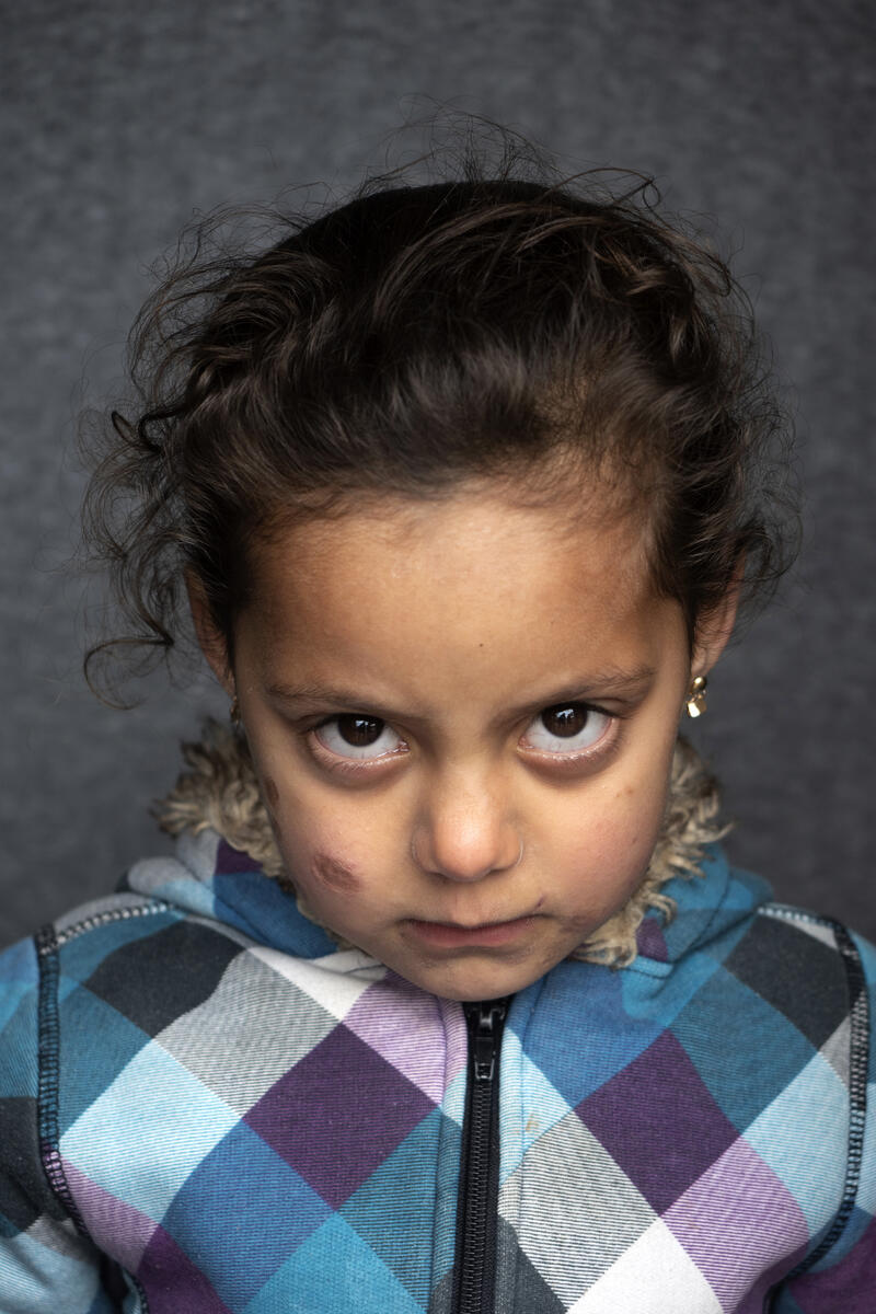 En liten pike fra flyktningeleir, hun ser inn i kameraet med et blikk som sier: If looks could kill.