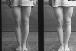 To eksponeringer av bare lår og legger.